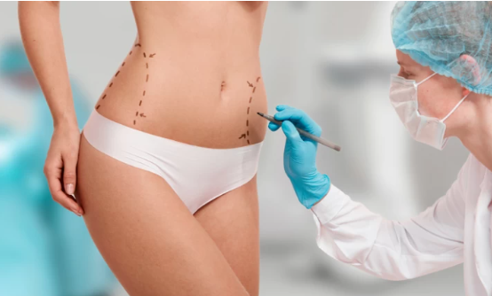 جراحی زیبایی بدن توسط فوق تخصص جراحی پلاستیک و زیبایی
