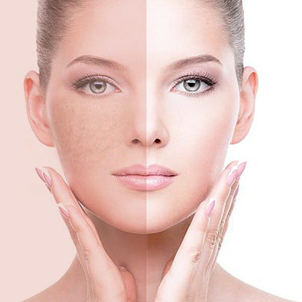 جوانسازی پوست صورت و گردن توسط فوق تخصص جراحی پلاستیک و زیبایی