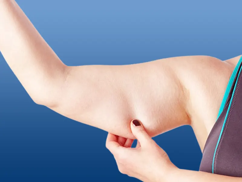 جراحی لیپوماتیک بازوها توسط بهترین فوق تخصص جراحی زیبایی