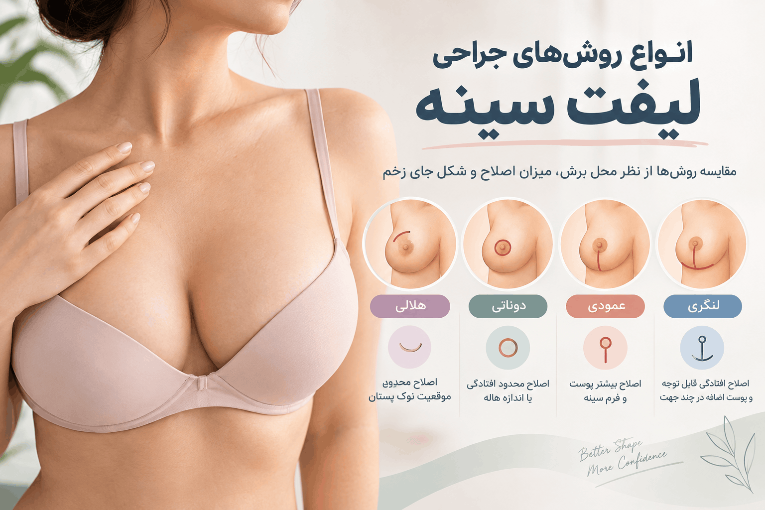انواع روش‌های جراحی لیفت سینه و تفاوت برش‌ها